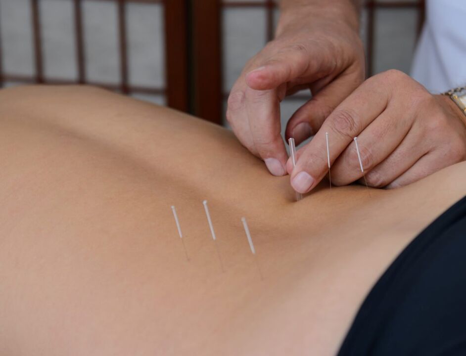 Akupunktur fir Prostatitis
