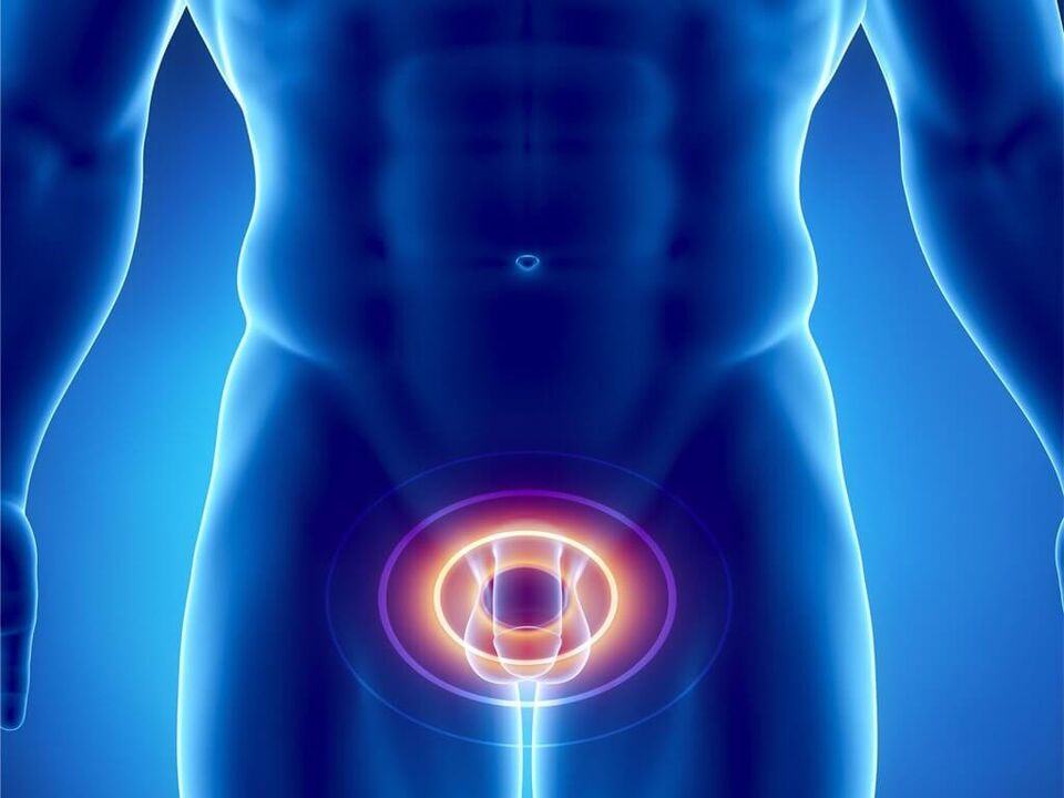 Symptomer vun Prostatitis bei Männer